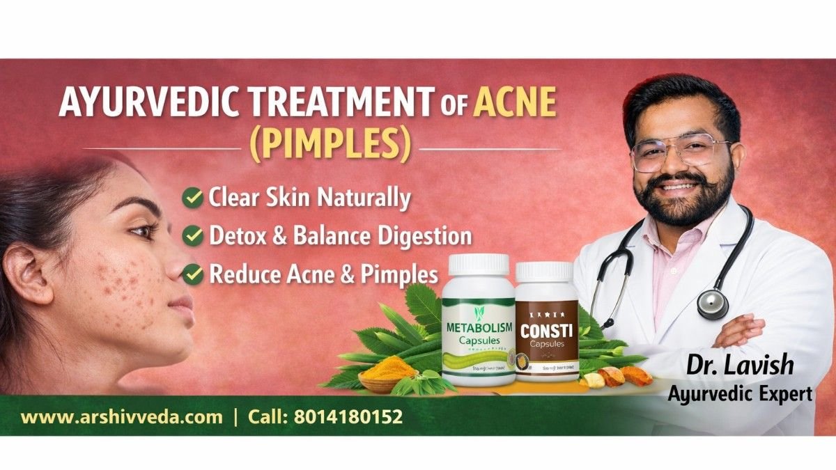Ayurvedic Treatment for Acne: Natural Pimples Cure with Metabolism & Consti Capsules