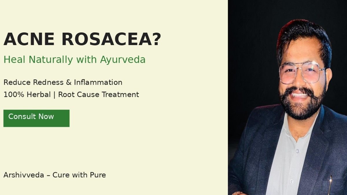 Acne Rosacea Treatment in Ayurveda: Causes, Symptoms & Natural Herbal Cure